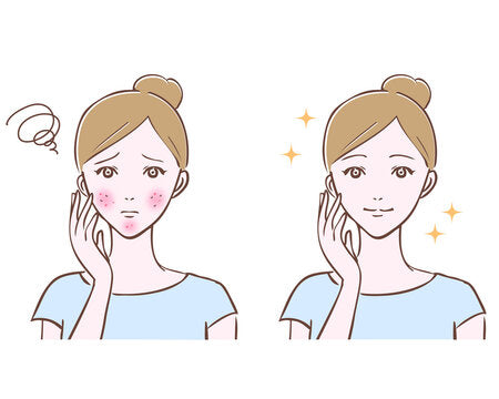 春の敏感ゆらぎ肌